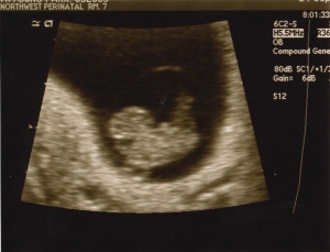 ultrasound 2014-09-24 improved 4.jpg